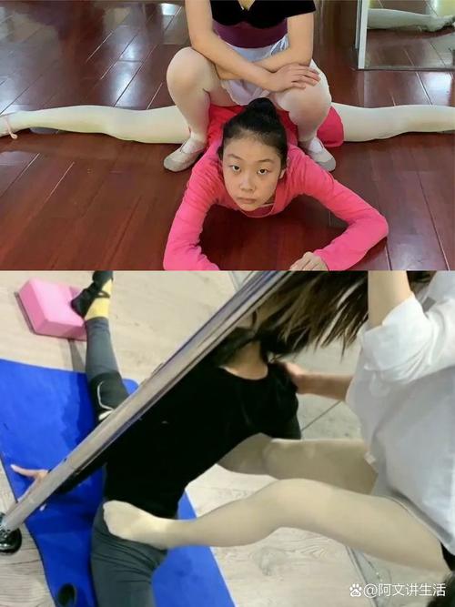 女孩学舞蹈受伤,是天赋不足还是训练不当?-第1张图片-泰美艺术培训 女孩学舞蹈受伤,是天赋不足还是训练不当?-第1张图片-泰美艺术培训